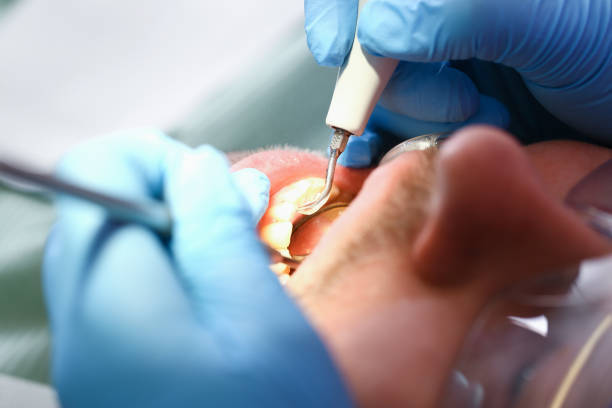Best Orthodontic Emergency Dentist in West Milton, OH