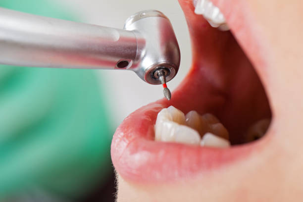 Best Emergency Cosmetic Dentistry in West Milton, OH